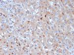 Alpha-1-Antichymotrypsin (SERPINA3) (Histiocytoma Marker) Antibody in Immunohistochemistry (Paraffin) (IHC (P))