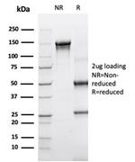 Alpha-1-Antichymotrypsin (SERPINA3) (Histiocytoma Marker) Antibody in SDS-PAGE (SDS-PAGE)