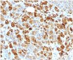 Alpha-1-Antichymotrypsin (SERPINA3) (Histiocytoma Marker) Antibody in Immunohistochemistry (Paraffin) (IHC (P))