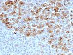 Alpha-1-Antichymotrypsin (SERPINA3) (Histiocytoma Marker) Antibody in Immunohistochemistry (Paraffin) (IHC (P))