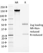 Alpha-1-Antichymotrypsin (SERPINA3) (Histiocytoma Marker) Antibody in SDS-PAGE (SDS-PAGE)