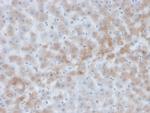 Alpha-1-Antichymotrypsin (SERPINA3) (Histiocytoma Marker) Antibody in Immunohistochemistry (Paraffin) (IHC (P))