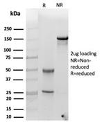 Alpha-1-Antichymotrypsin (SERPINA3) (Histiocytoma Marker) Antibody in SDS-PAGE (SDS-PAGE)