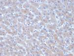 Alpha-1-Antichymotrypsin (SERPINA3) (Histiocytoma Marker) Antibody in Immunohistochemistry (Paraffin) (IHC (P))