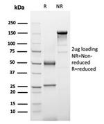 Alpha-1-Antichymotrypsin (SERPINA3) (Histiocytoma Marker) Antibody in Immunoelectrophoresis (IE)