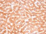 Alpha-1-Antichymotrypsin (SERPINA3) (Histiocytoma Marker) Antibody in Immunohistochemistry (Paraffin) (IHC (P))