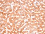 Alpha-1-Antichymotrypsin (SERPINA3) (Histiocytoma Marker) Antibody in Immunohistochemistry (Paraffin) (IHC (P))