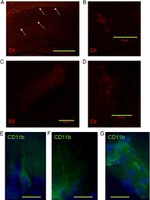 CD11b Antibody in Immunohistochemistry (IHC)