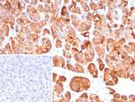 Colipase/CLPS Antibody in Immunohistochemistry (Paraffin) (IHC (P))