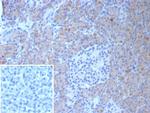 Colipase/CLPS Antibody in Immunohistochemistry (Paraffin) (IHC (P))