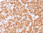 Clathrin, Light Chain Antibody in Immunohistochemistry (Paraffin) (IHC (P))