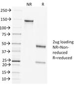 Clathrin, Heavy Chain Antibody in SDS-PAGE (SDS-PAGE)