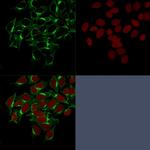 Clathrin, Heavy Chain Antibody in Immunocytochemistry (ICC/IF)