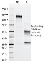 Adipophilin/Perilipin-2 Antibody in SDS-PAGE (SDS-PAGE)