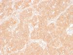 Adipophilin/Perilipin-2 Antibody in Immunohistochemistry (Paraffin) (IHC (P))