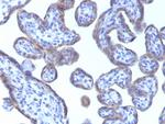 Adipophilin/Perilipin-2 (Marker of Lipid Accumulation) Antibody in Immunohistochemistry (Paraffin) (IHC (P))