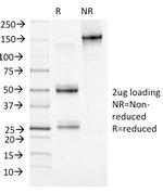 Adipophilin/Perilipin-2 (Marker of Lipid Accumulation) Antibody in SDS-PAGE (SDS-PAGE)