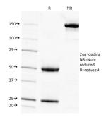 Adipophilin/Perilipin-2 (Marker of Lipid Accumulation) Antibody in SDS-PAGE (SDS-PAGE)