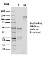 Adipophilin/Perilipin-2 Antibody in SDS-PAGE (SDS-PAGE)