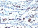 CD195 (CC-Chemokine Receptor 5) Antibody in Immunohistochemistry (Paraffin) (IHC (P))