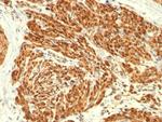 Calponin-1 (Smooth Muscle Marker) Antibody in Immunohistochemistry (Paraffin) (IHC (P))