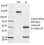 Calponin-1 (Smooth Muscle Marker) Antibody in SDS-PAGE (SDS-PAGE)