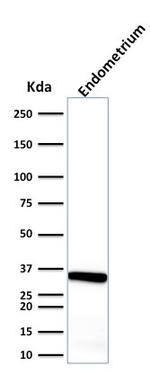 Calponin-1 (Smooth Muscle Marker) Antibody in Western Blot (WB)