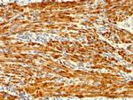 Calponin-1 (Smooth Muscle Marker) Antibody in Immunohistochemistry (Paraffin) (IHC (P))