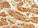 Calponin-1 (Smooth Muscle Marker) Antibody in Immunohistochemistry (Paraffin) (IHC (P))