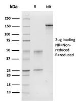 Calponin-1 (Smooth Muscle Marker) Antibody in SDS-PAGE (SDS-PAGE)