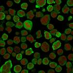 Calponin-1 (Smooth Muscle Marker) Antibody in Immunocytochemistry (ICC/IF)