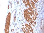 Calponin-1 (Smooth Muscle Marker) Antibody in Immunohistochemistry (Paraffin) (IHC (P))