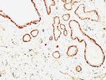 Calponin-1 (Smooth Muscle Marker) Antibody in Immunohistochemistry (Paraffin) (IHC (P))