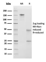 Calponin-1 (Smooth Muscle Marker) Antibody in SDS-PAGE (SDS-PAGE)