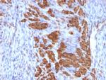 Calponin-1 (Smooth Muscle Marker) Antibody in Immunohistochemistry (Paraffin) (IHC (P))