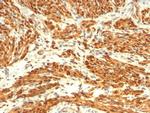 Calponin-1 (Smooth Muscle Marker) Antibody in Immunohistochemistry (Paraffin) (IHC (P))