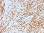 Calponin-1 Antibody in Immunohistochemistry (Paraffin) (IHC (P))