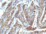 Calponin-1 (Smooth Muscle Marker) Antibody in Immunohistochemistry (Paraffin) (IHC (P))