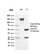 Collagen IV Antibody in SDS-PAGE (SDS-PAGE)