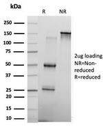 KLF17/ ZNF393 Antibody in SDS-PAGE (SDS-PAGE)