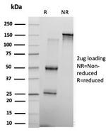 KLF17/ZNF393 Antibody in Immunoelectrophoresis (IE)