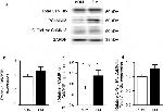 CaMKII delta Antibody in Western Blot (WB)