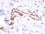 Collagen VII Antibody in Immunohistochemistry (Paraffin) (IHC (P))