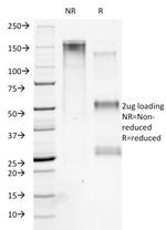 Collagen VII Antibody in SDS-PAGE (SDS-PAGE)