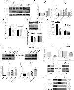 Acetyl-alpha Tubulin (Lys40) Antibody in Western Blot (WB)