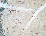 MAP2 Antibody in Immunohistochemistry (IHC)