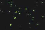 Ubiquitin Antibody in Immunohistochemistry (IHC)