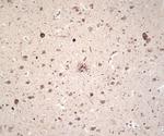 Ubiquitin Antibody in Immunohistochemistry (IHC)