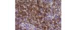 CD4 Antibody in Immunohistochemistry (Paraffin) (IHC (P))