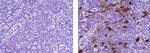 Mouse IgG (H+L) Secondary Antibody in Immunohistochemistry (Paraffin) (IHC (P))